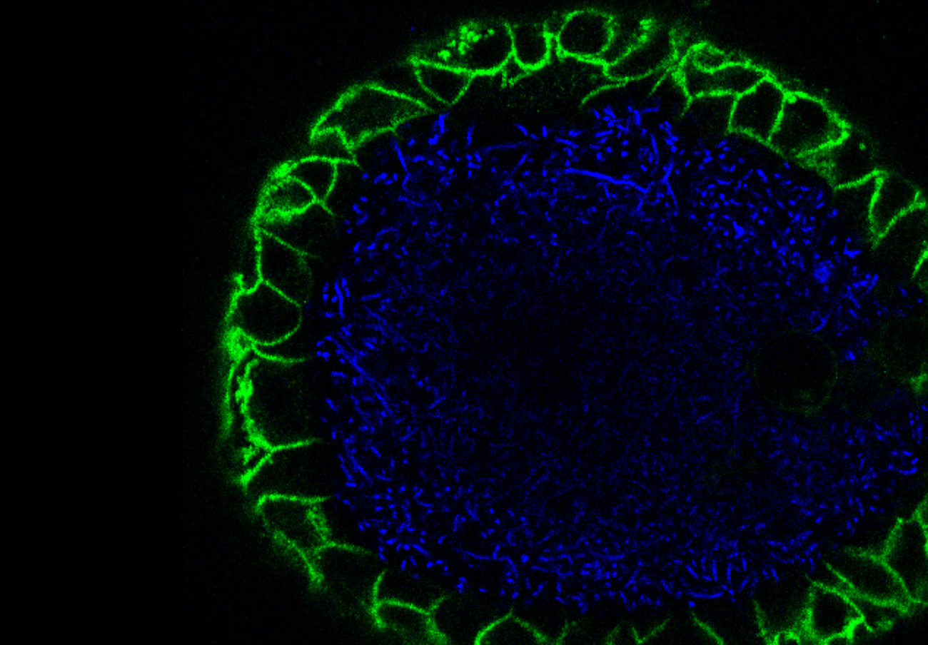Imagen de microscopía de fluorescencia de un mini-órgano intestinal (verde) co-cultivado con bacterias intestinales (azul). | Imagen: Cayetano Pleguezuelos Manzano, Jens Puschhof y Axel Rosendahl Huber, Hubrecht Institute.